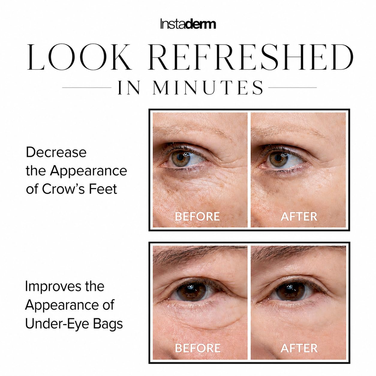Instant Eye Tightener Cream – Instantly Reduces the Appearance of Under-Eye Bags, Puffiness, Dark Circles, Fine Lines