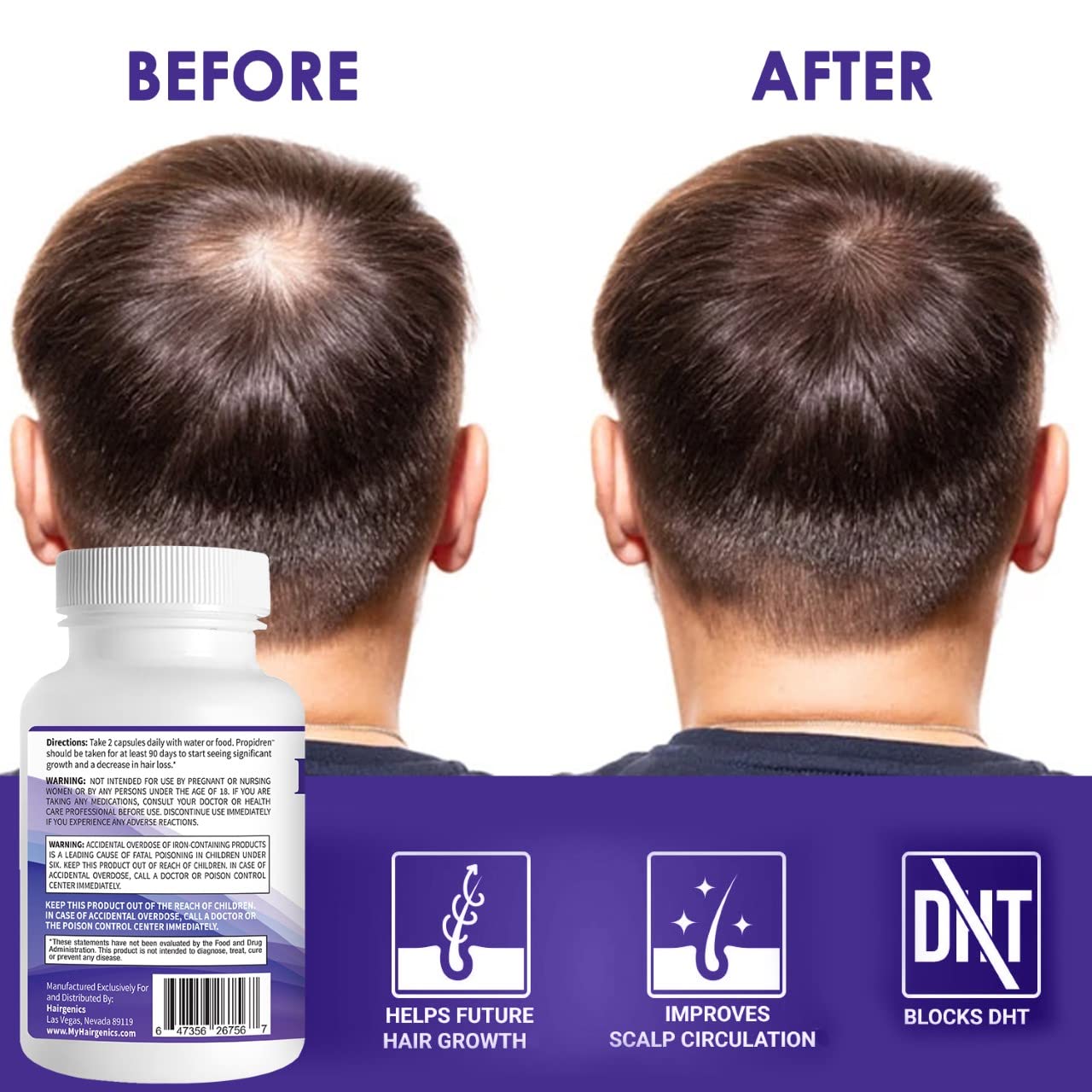 Propidren DHT Blocker & Hair Growth Pills To Stop Hair Loss and Regrow Hair | Hair Vitamins for Men & Women, Regrowth, DHT Blocking, Thinning Hair