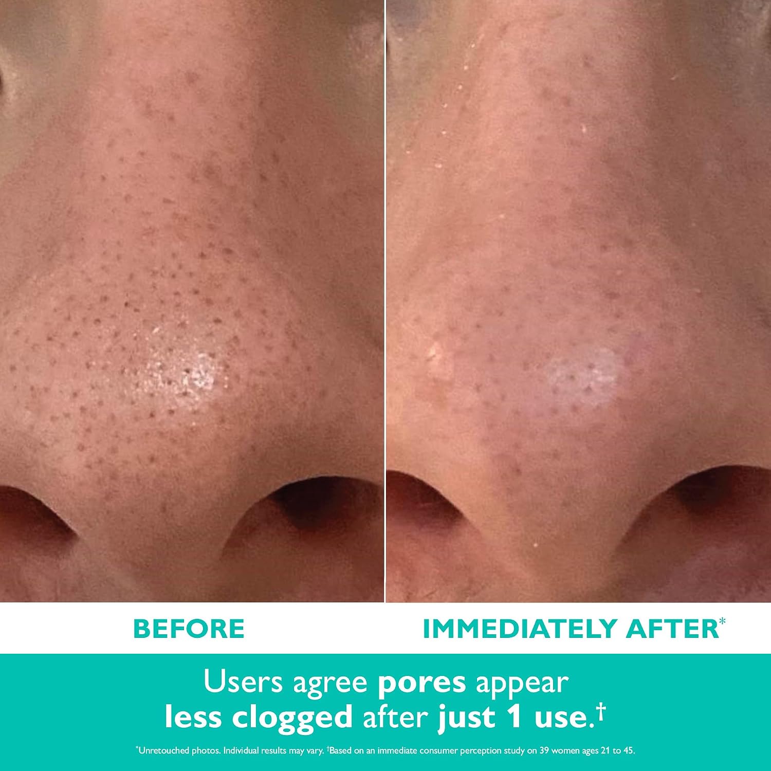 Peter Thomas Roth | Even Smoother™ Microdermabrasion Exfoliating Pore Purifier with Salicylic Acid for Oil Control