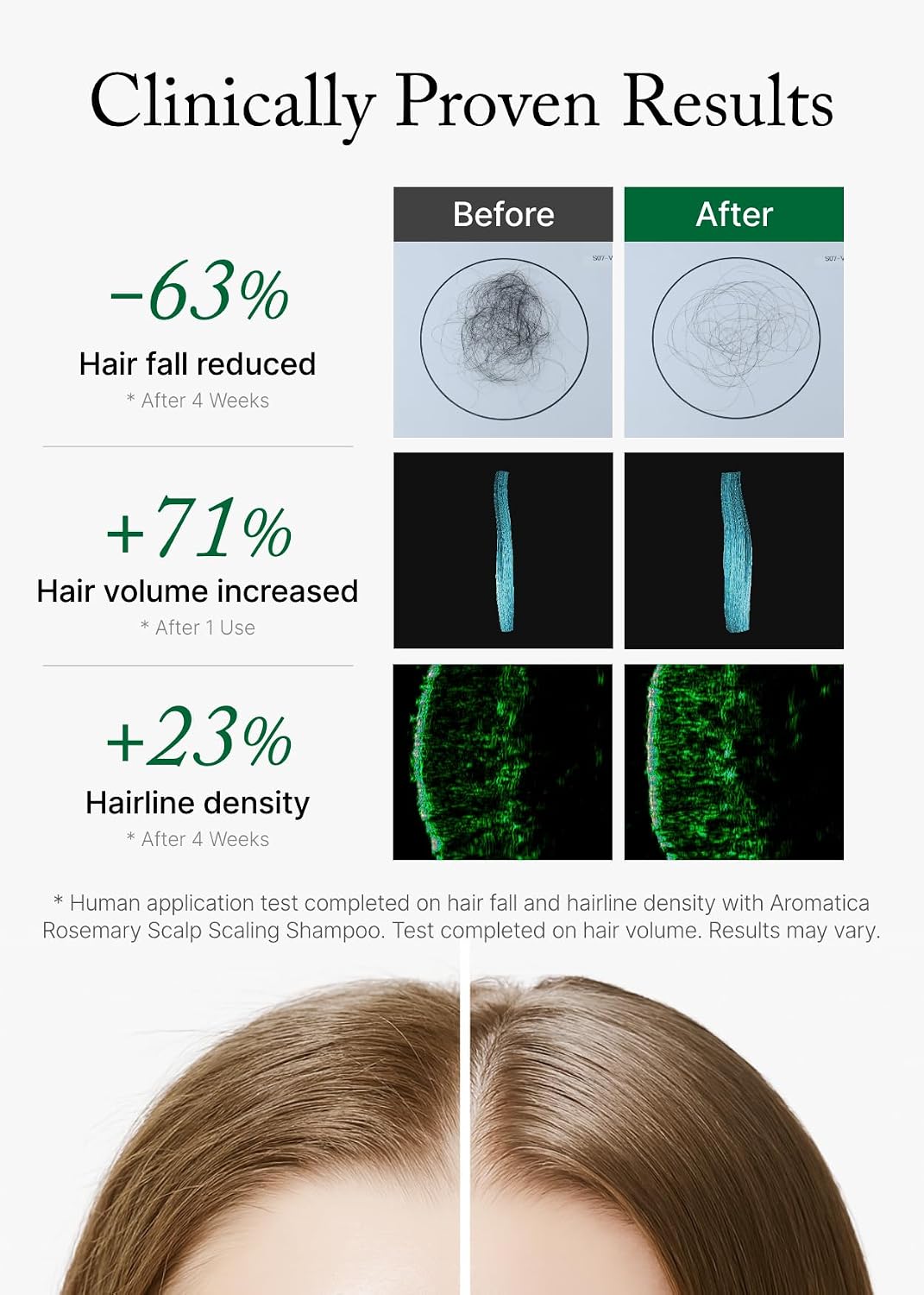 AROMATICA Rosemary Scalp Scaling Shampoo for Hair Growth | Korean Hair Care for Thinning Hair & Hair Loss, Natural Essential Oil, Vegan, Sulfate Silicone Paraben Free (13.53 oz)