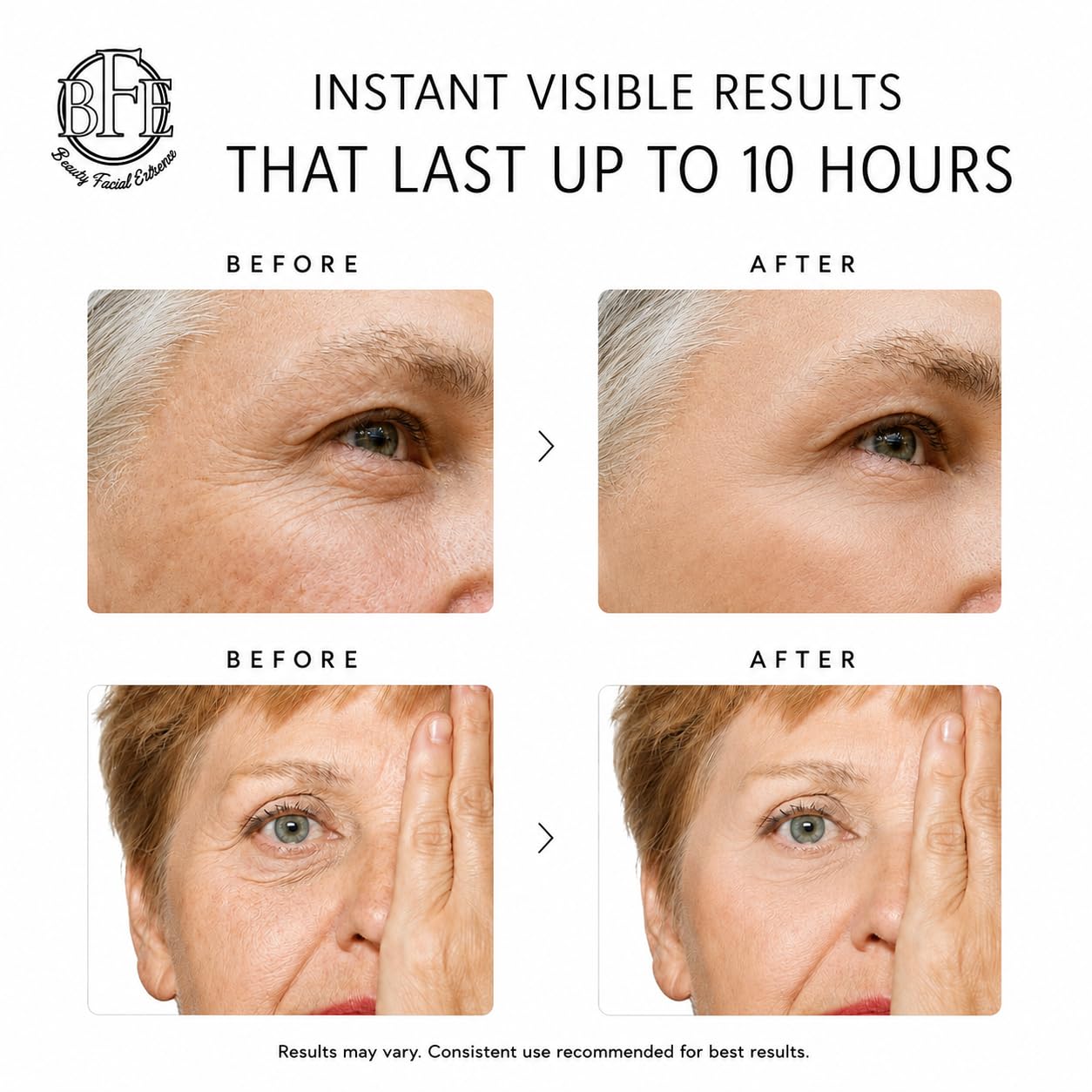 Instant Eye Tightener Cream - Instantly Reduces Under Eye Puffiness, Bags