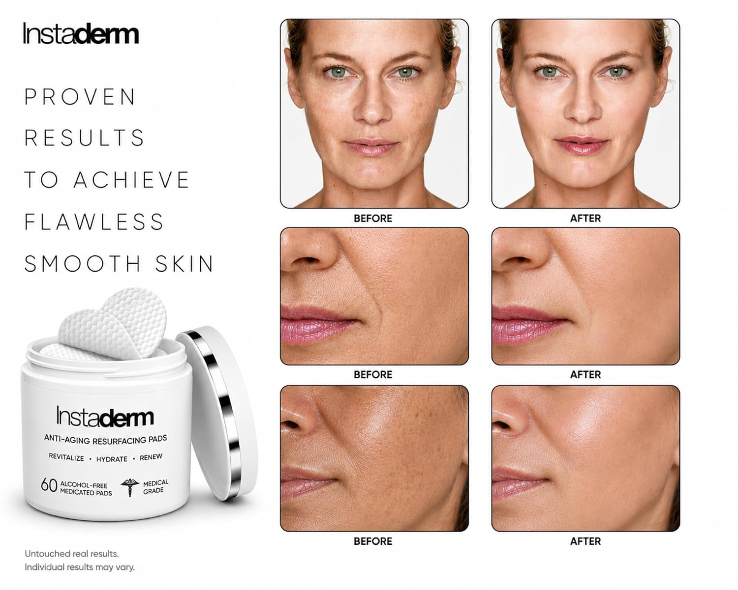 Anti-Aging Resurfacing Pads – Smooth’s Fine Lines, Wrinkles, Dark Spots, Freckles