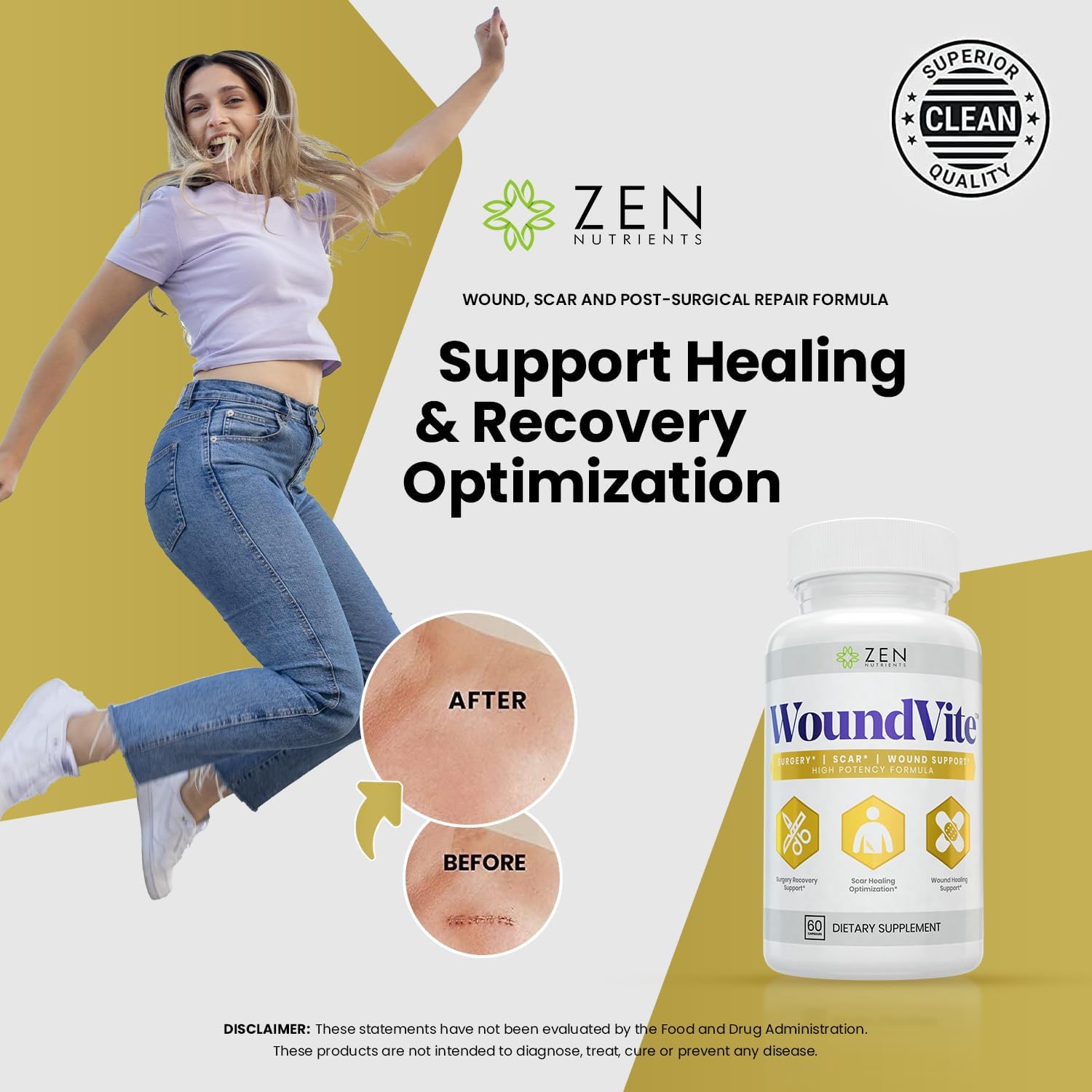 Zen Nutrients WoundVite Pre & Post Surgery Support, Scar & Wound Care, Scar Treatment, Plastic & General Surgery