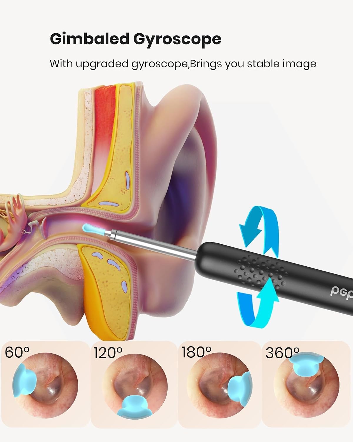 BEBIRD R1 Ear Wax Removal Tool:Ear Cleaner with HD Ear Camera FSA&HSA