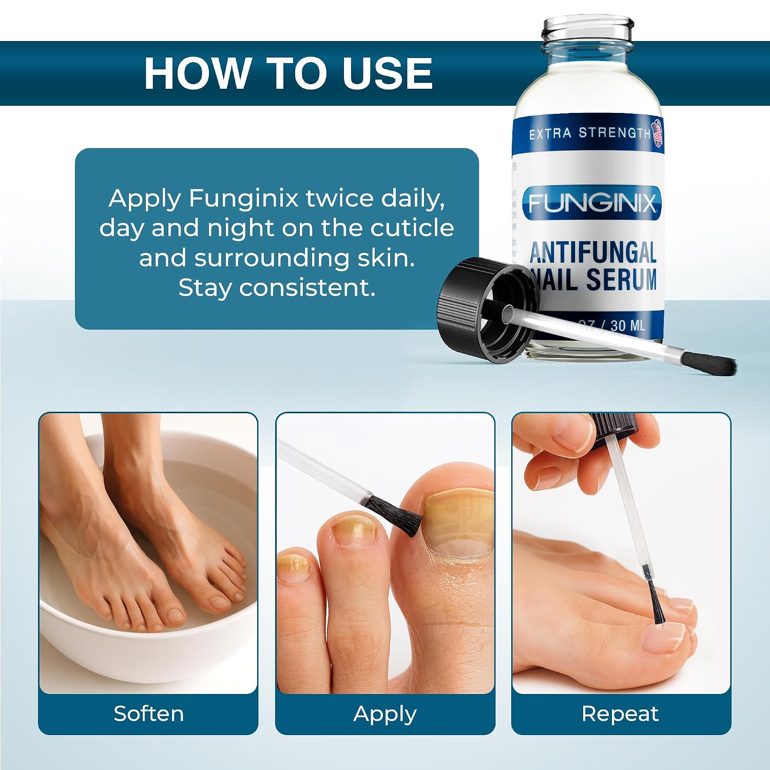 FUNGINIX Toenail Fungus Treatment Extra Strength - Antifungal Nail Treatment With 10% Undecylenic Acid & Tea Tree Oil - Includes Natural Oils & Botanicals - Made in USA (Packaging Does Vary)