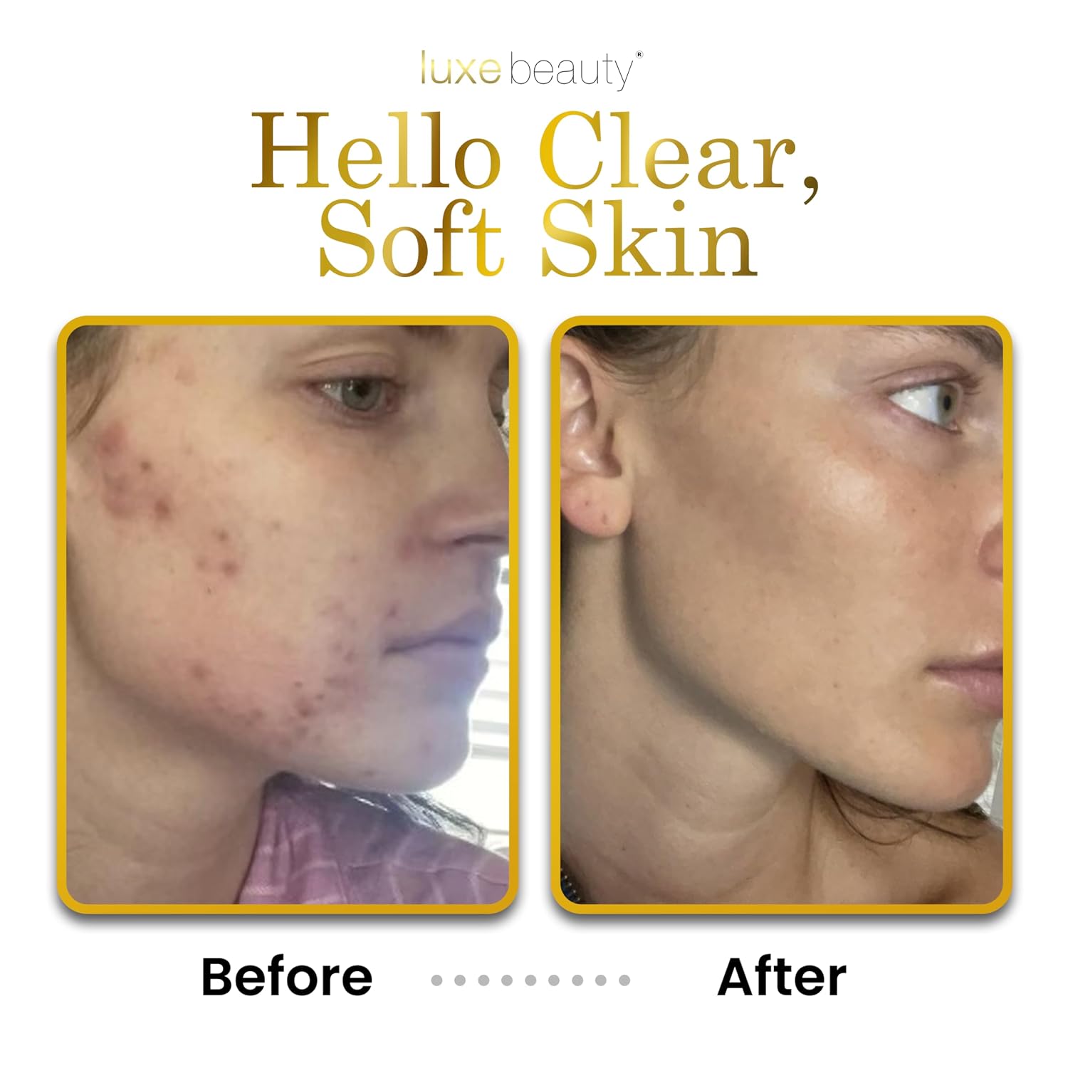 LUXELOTION is truly a Luxury Product - an Anti-Aging Face, Hand & Body Lotion with Hyaluronic Acid. This Lightweight and Non-Greasy Formula creates Silky Smooth Skin.