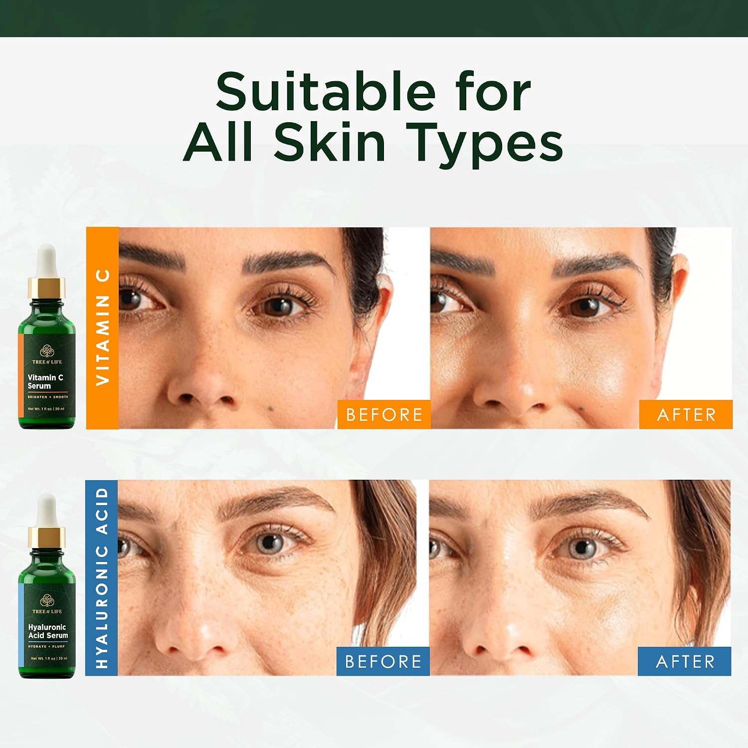 Tree of Life Vitamin C Serum for Face - Brightening and Hydrating Face Oil for Dark Spots and Fine Lines - Suitable for Sensitive Skin - Dermatologist Tested Skin Care - 1 Fl Oz | Brightening Vitamin C serum for face. Hydrating face oil that targets dark…