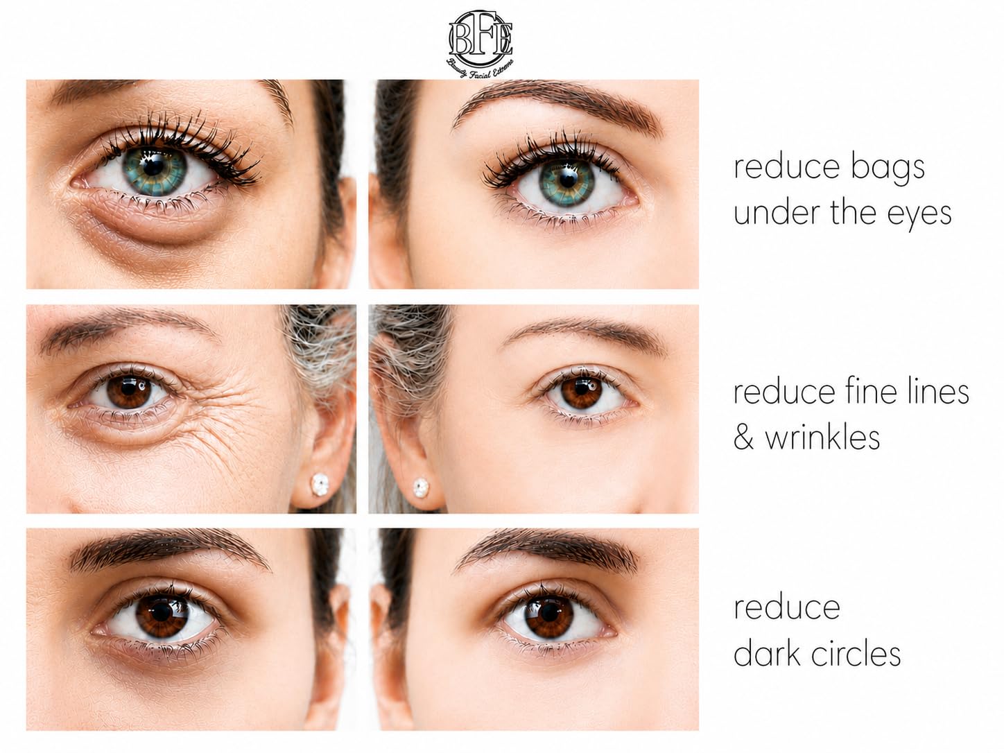 Instant Eye Tightener Cream - Instantly Reduces Under Eye Puffiness, Bags