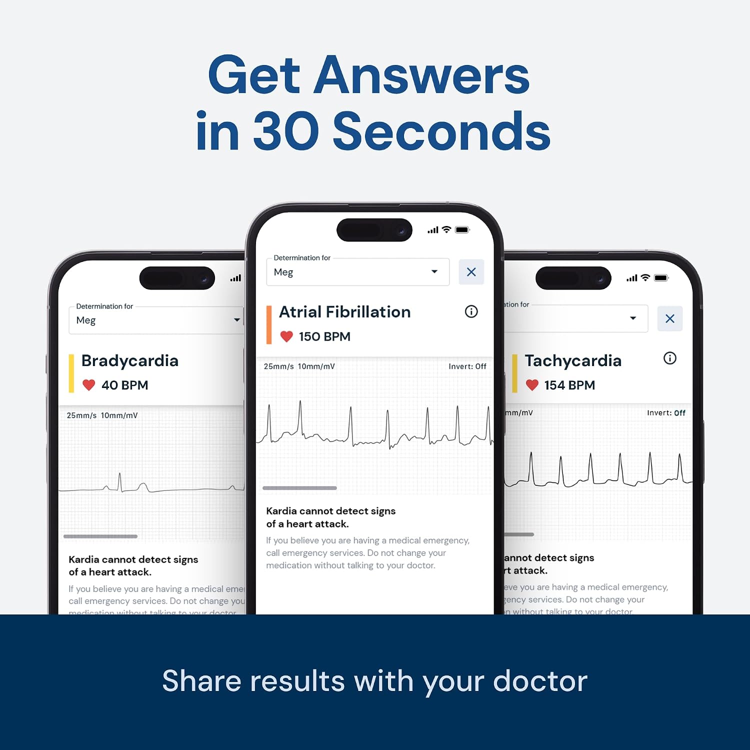 KardiaMobile 1-Lead EKG Monitor, Medical-Grade FDA-Cleared Personal Heart Monitor, Detects Normal, AFib & Arrhythmias, 30 Second Results