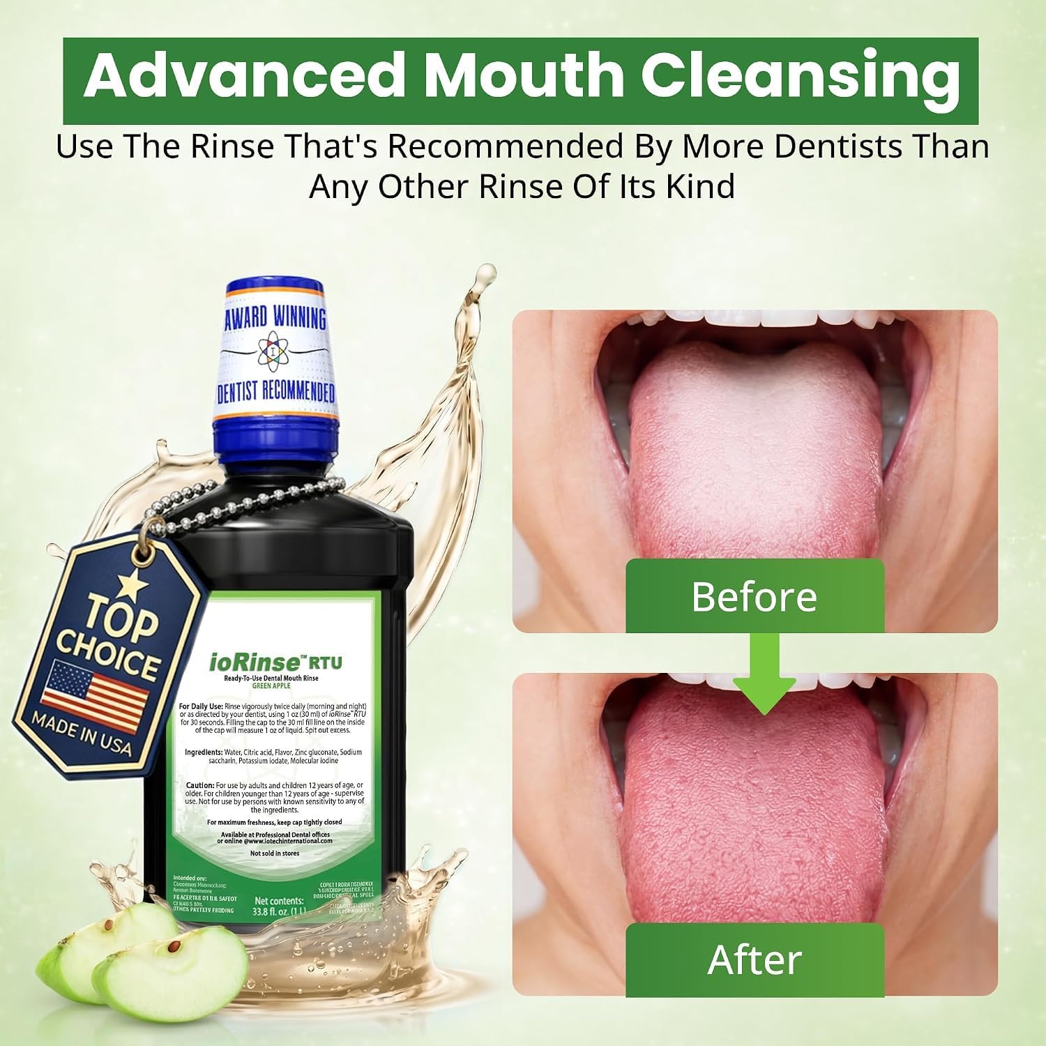 ioRinse RTU Halitosis Mouthwash, Molecular Iodine Oral Rinse, Soft Mint, 1L