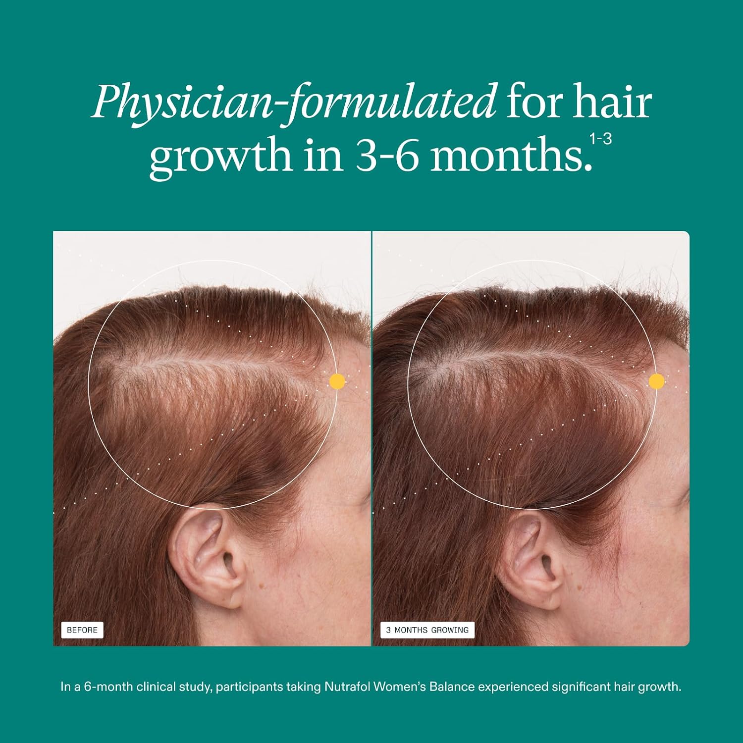 Nutrafol Women's Balance Hair Growth Supplements, Age 45+, 1-Month Bottle | #1 Dermatologist-Recommended Hair Growth Supplement Brand