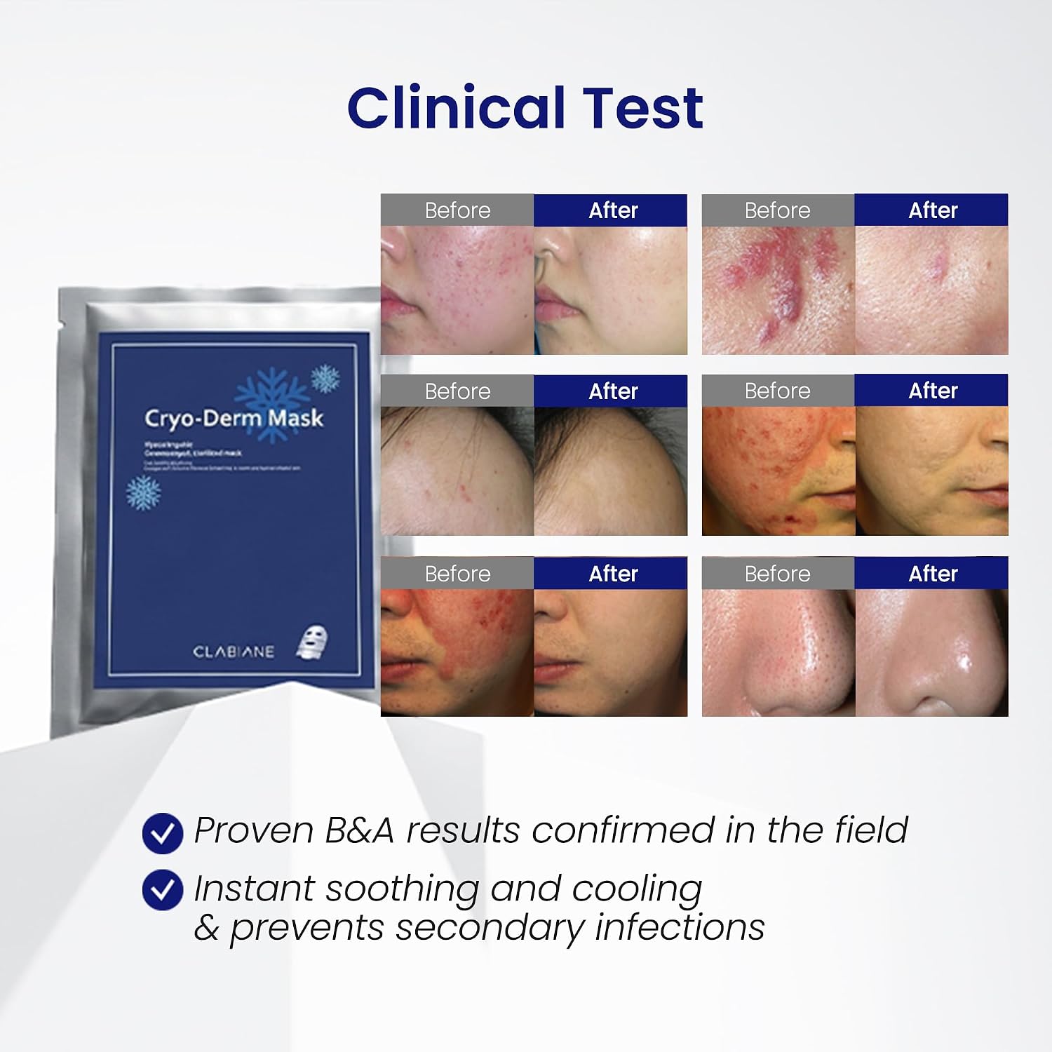 Cryo-Derm Mask, Gamma-ray satilization, No preservatives, Post-care after laser treatment, Hypoallergenic