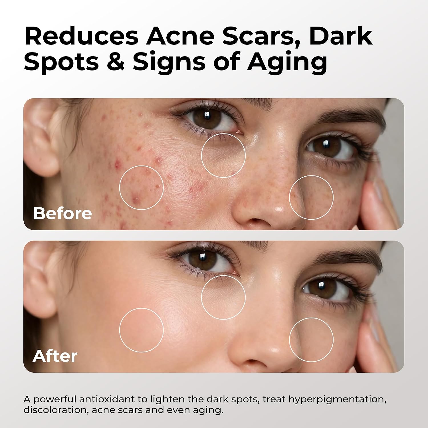 Skin Deva 20% Vitamin C Serum Anti Aging with Hyaluronic Acid & Vitamin E Ferulic Acid - Brightening Formula for Improving Appearance of Dark Spots, Fine Lines & Wrinkles - All Skin Types, 1 fl oz