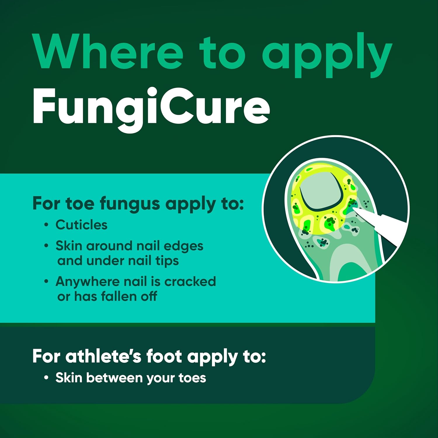 FUNGICURE Medicated Liquid Gel - Maximum Strength 0.35 Fluid Ounce | Cures fungal infections & kills 6 types of fungus. Clinically proven