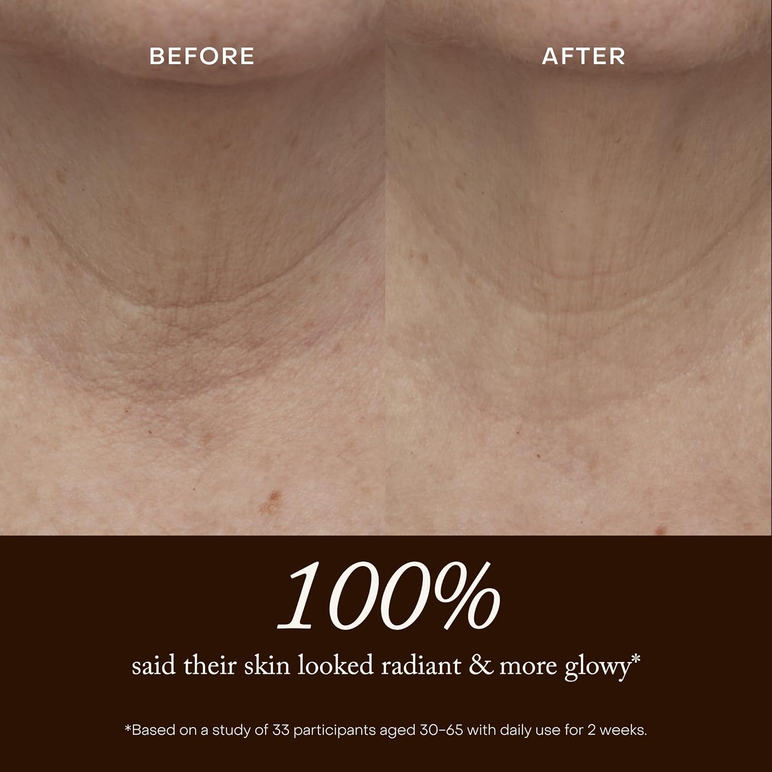 True Botanicals Pure Radiance Body Oil | Anti-Aging Body Oil for All Skin Types | Moisturize & Restore Skin Health | Dermatologist Tested, All Natural