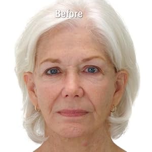 image of fifty five year old woman before applying Insta Tox face show lines and dropping eye brows