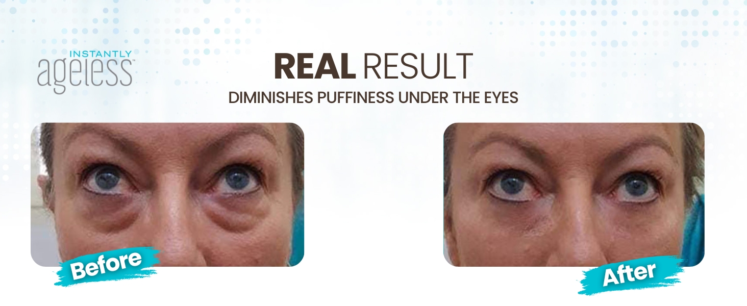 instantly ageless under eye bag remover ageles instliftantly ageless ageless i bag remover creme