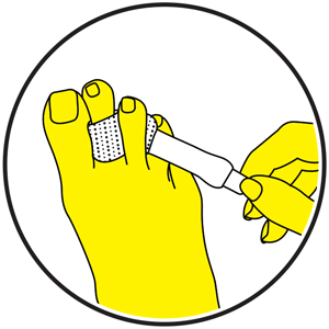 toe straight realigns hammer toes overlapping crooked profoot