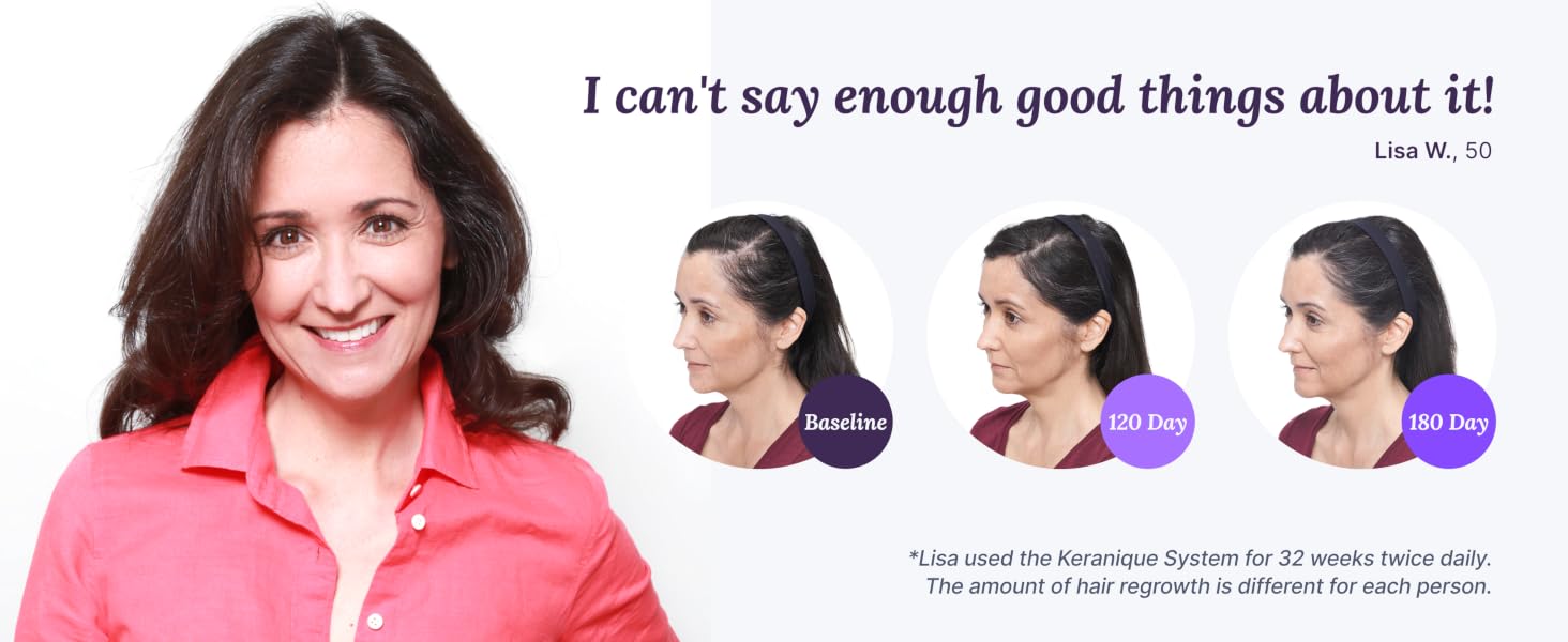 Hair regrowth transformation of a mature woman who used to have thin damaged hair