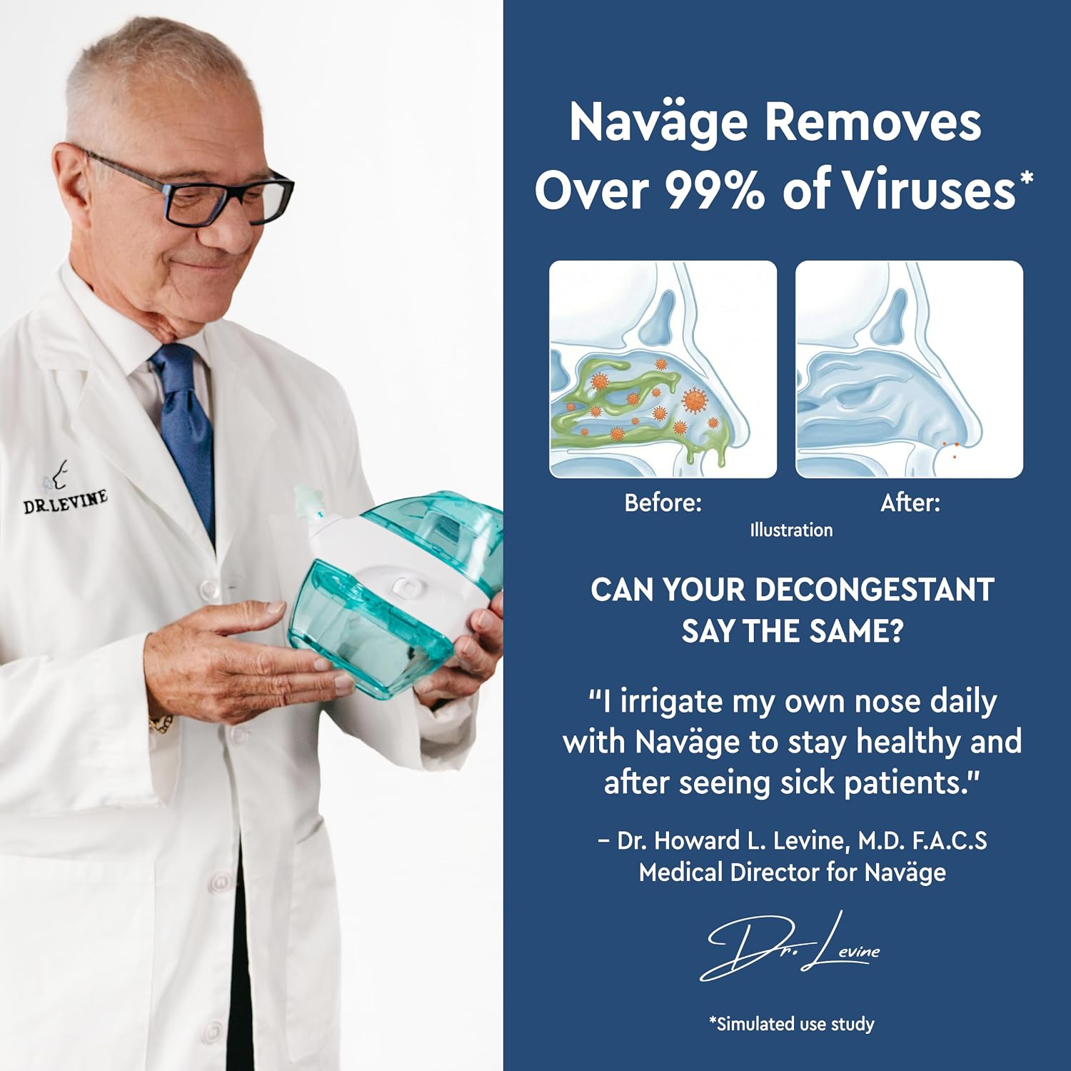 NAVAGE® Deluxe Bundle: Nose Cleaner, 30 SaltPods, Caddy, Black Bag | Deluxe Set: Powered Nose Sinus Cleaner, Storage Caddy, Batteries & Matching Black Travel Bag for Congestion & Sinus Relief