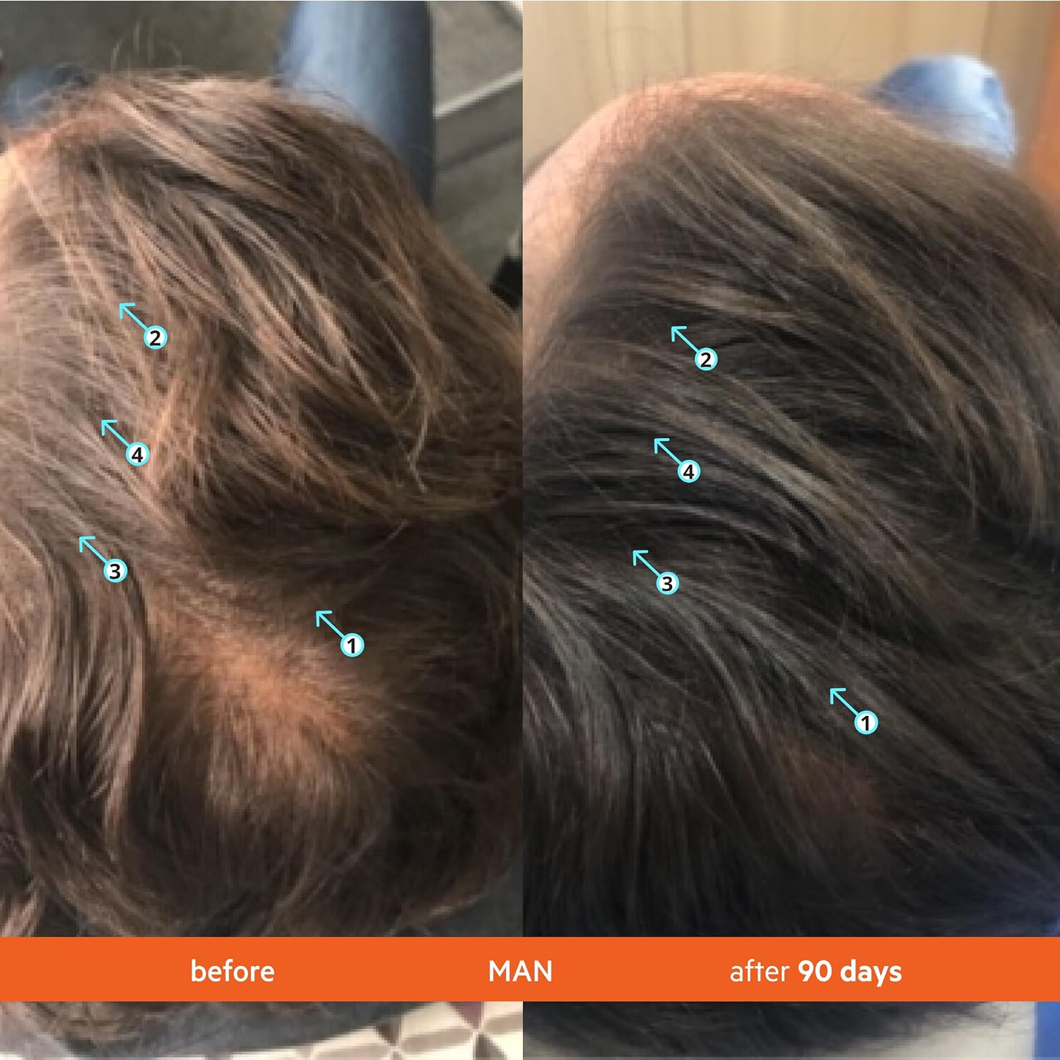 DS Labs Revita Hair Density Shampoo & Conditioner for Thinning Hair, 205 mL | Complete hair care routine powered by peptides, turmeric, caffeine & ginseng for healthier-looking, fuller-looking hair.