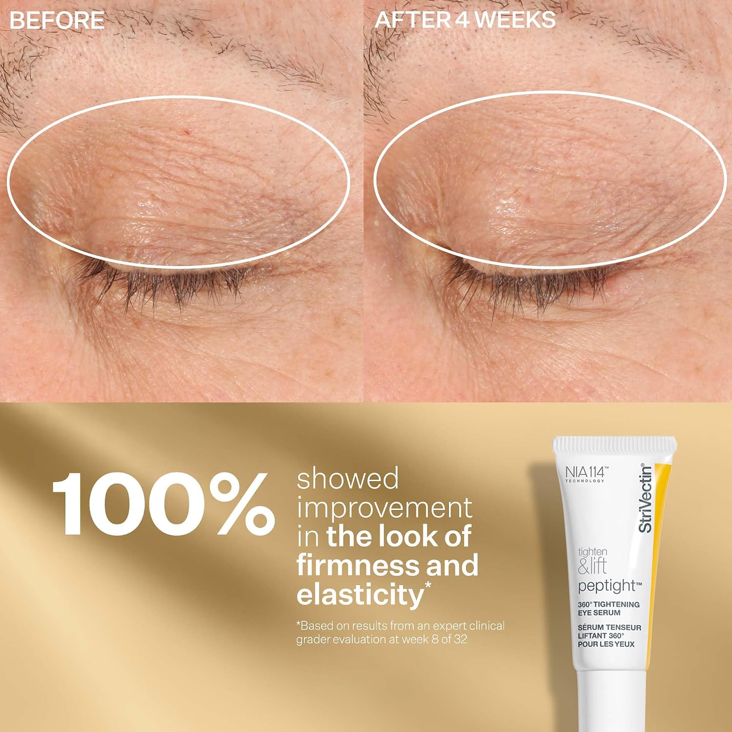 StriVectin Tighten & Lift Peptight Face Lift Serum with Tightening & Brightening Peptides for Wrinkles