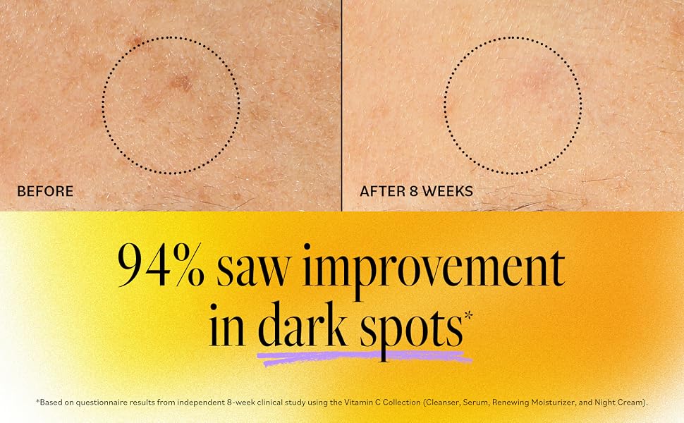 Derma E Vitamin Renewing Moisturizer Before and After