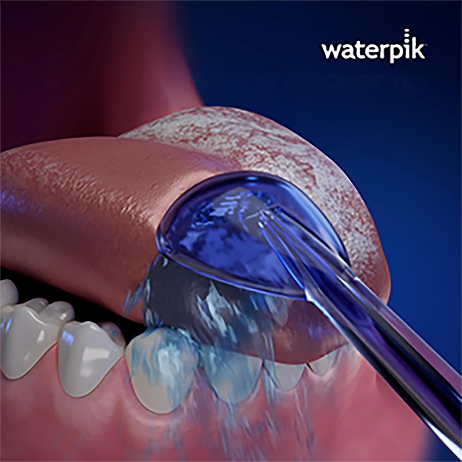 Waterpik Water Flosser Tongue Cleaner Replacement Tips, 2 Count TC-100E | Genuine Waterpik Brand Refill Nozzles Heads, for Bad Breath & Oral Hygiene