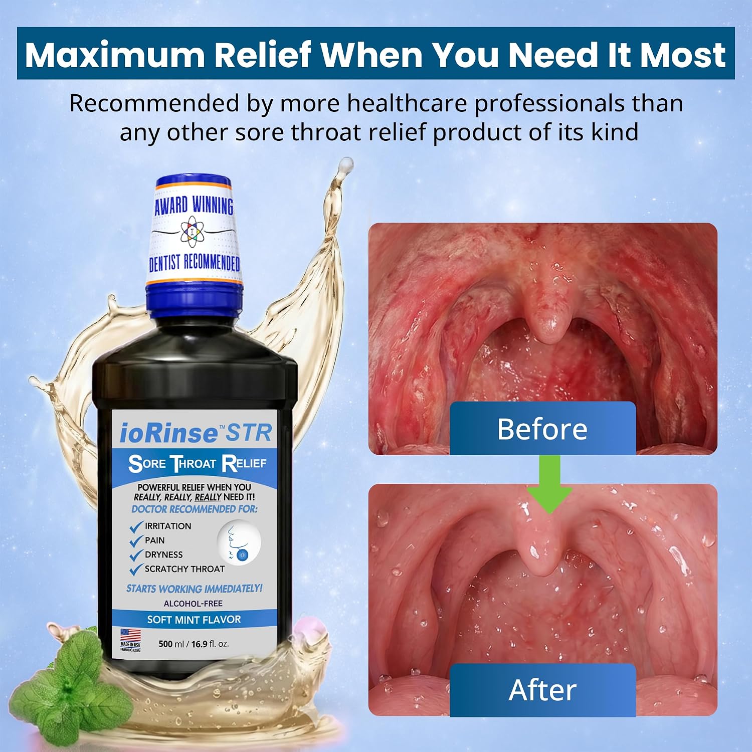 ioRinse RTU Halitosis Mouthwash, Molecular Iodine Oral Rinse, Soft Mint, 1L