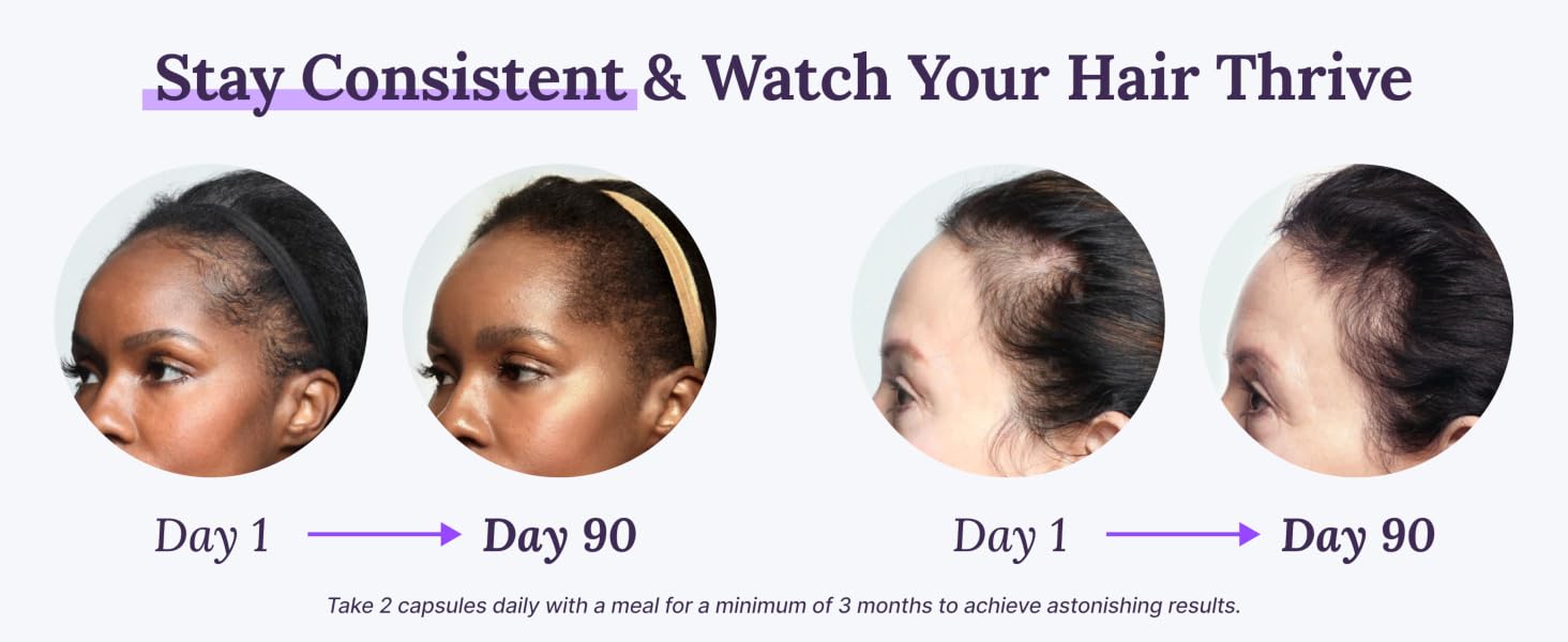 Two examples of women who experienced fast hair growth in 90 days with Keranique hair supplements