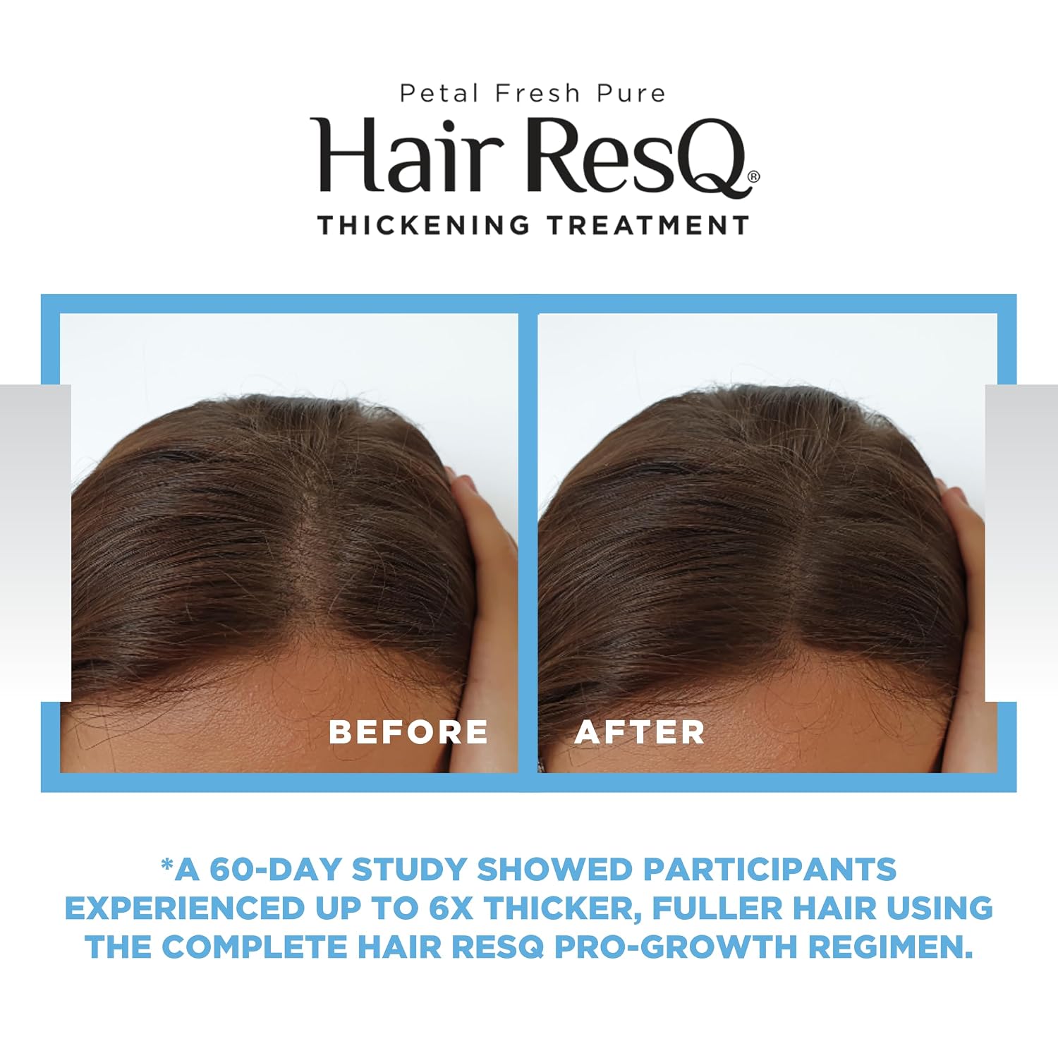 Petal Fresh Hair ResQ Biotin Shampoo for Thinning Hair, Clinically Tested Thickening, Pro-Growth Shampoo for Women & Men, Up to 6X Volume, Rosemary Mint, Caffeine & Peptides, Sulfate Free, 12 fl oz