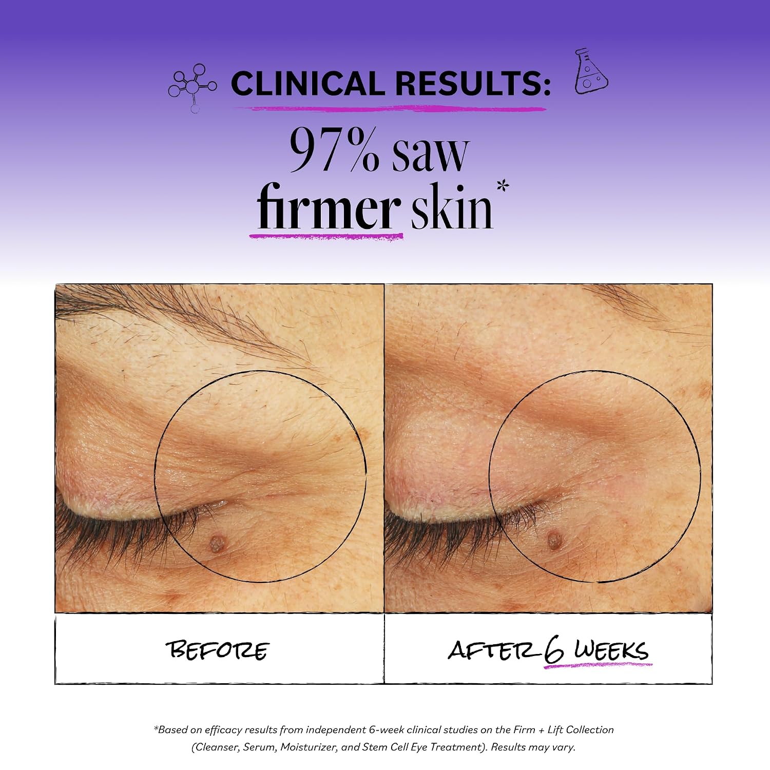 Derma E Stem Cell Lifting Eye Treatment – Multi Action Firming and Tightening Under Eye and Upper Eyelid Cream - Hydrating and Revitalizing