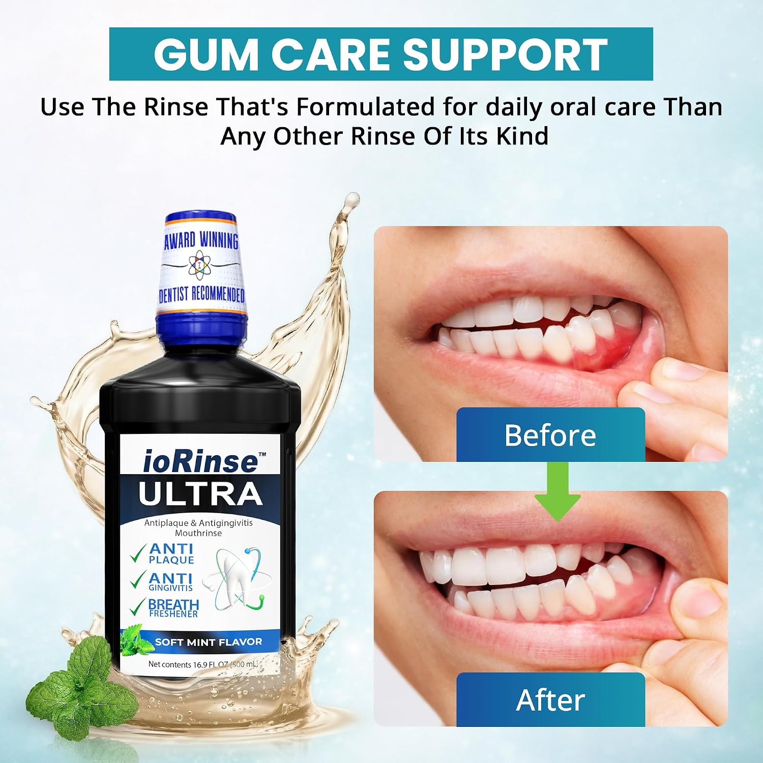 ioRinse RTU Halitosis Mouthwash, Molecular Iodine Oral Rinse, Soft Mint, 1L
