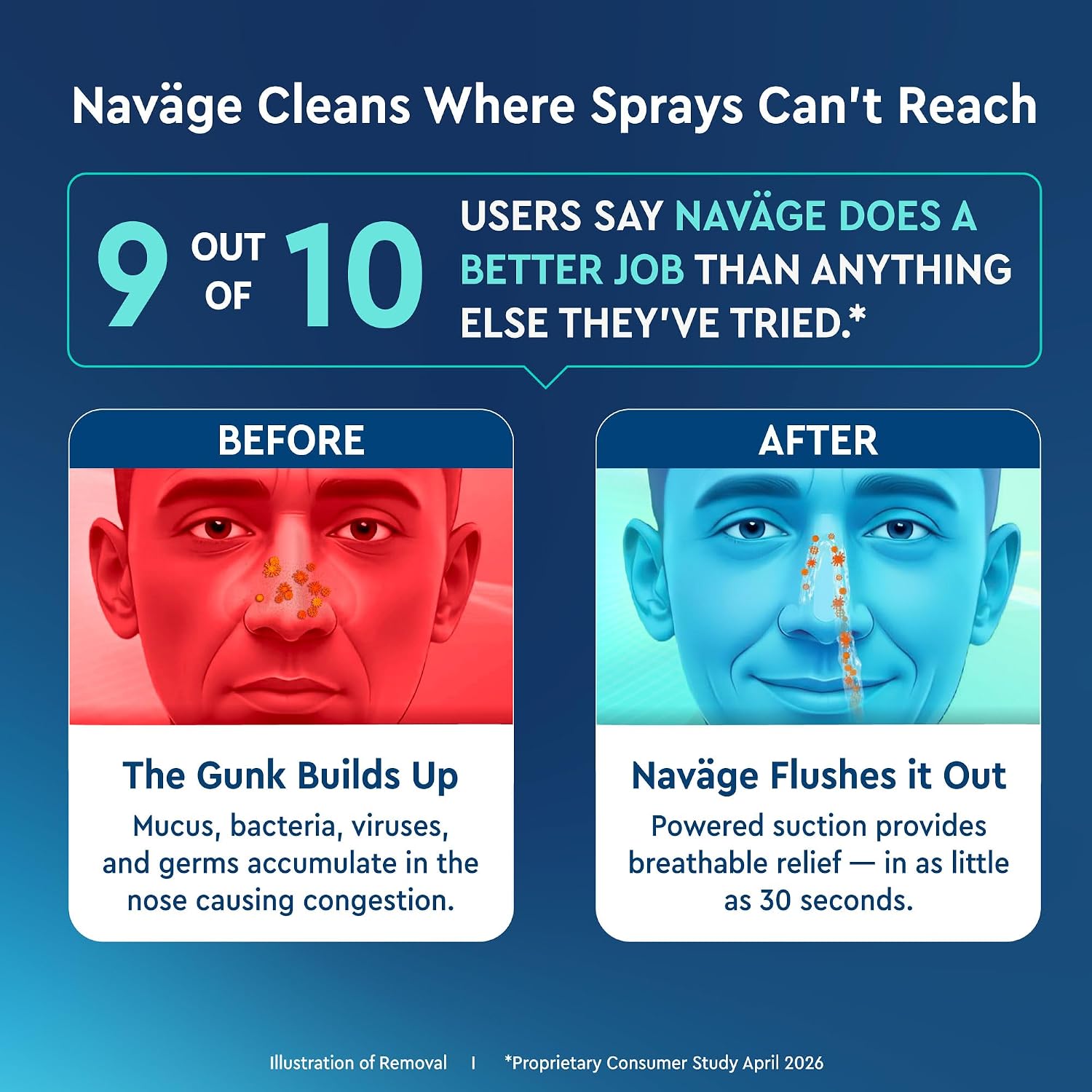 NAVAGE® Deluxe Bundle: Nose Cleaner, 30 SaltPods, Caddy, Black Bag | Deluxe Set: Powered Nose Sinus Cleaner, Storage Caddy, Batteries & Matching Black Travel Bag for Congestion & Sinus Relief
