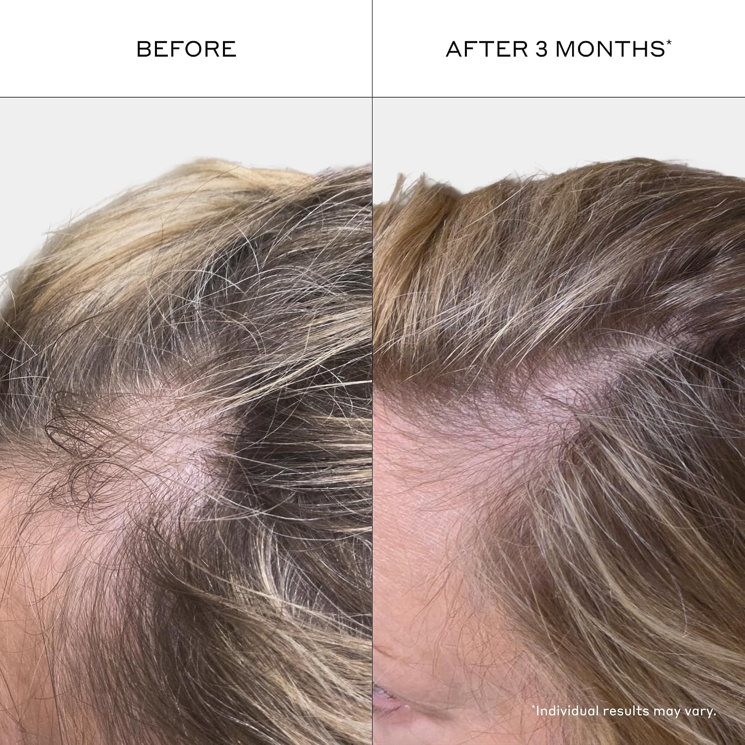 Zenagen Revolve Women's Thickening Shampoo | 5 Minute Hair Treatment