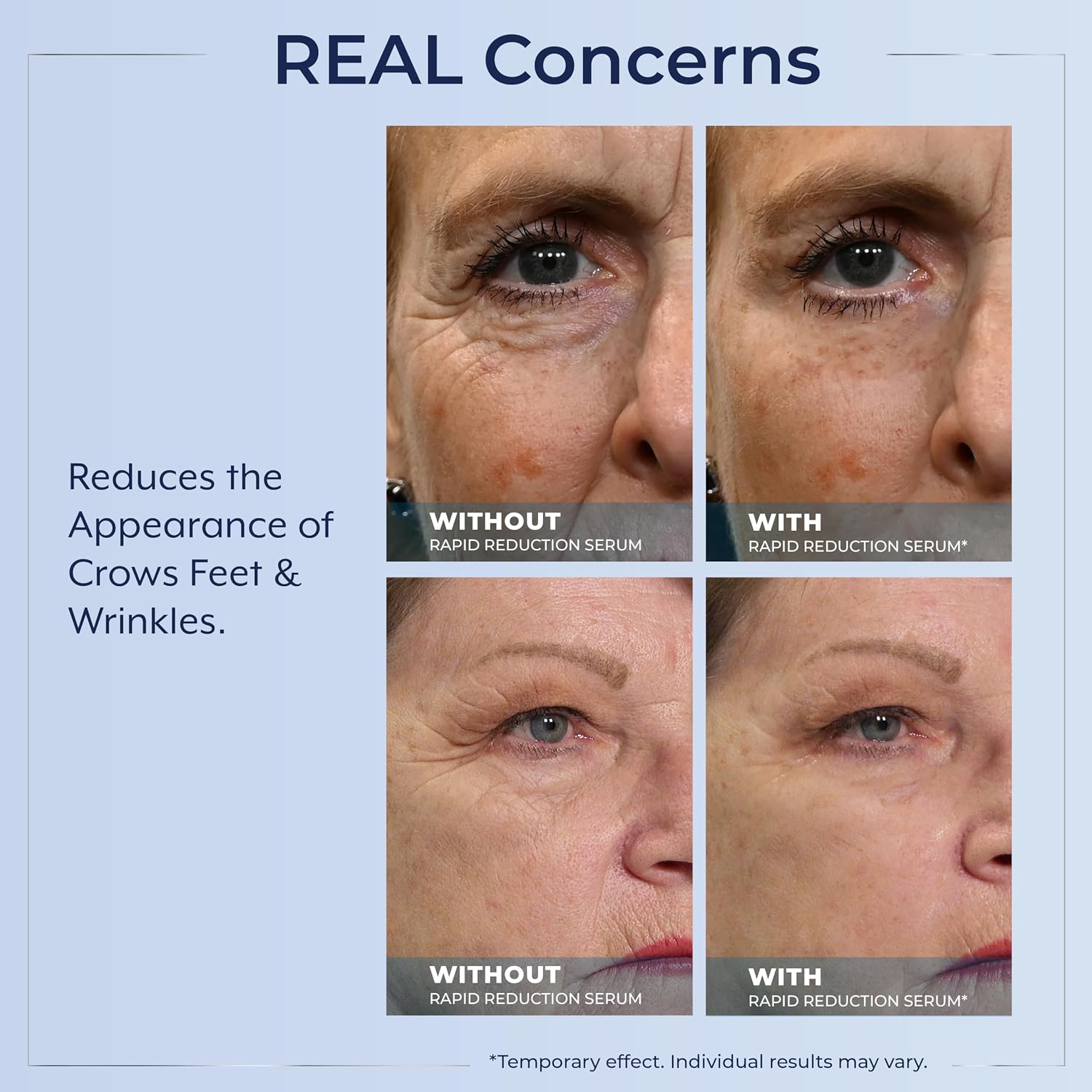 Plexaderm Eye Serum, 30 Single Use Pods - Visibly Reduces Bags & Wrinkles