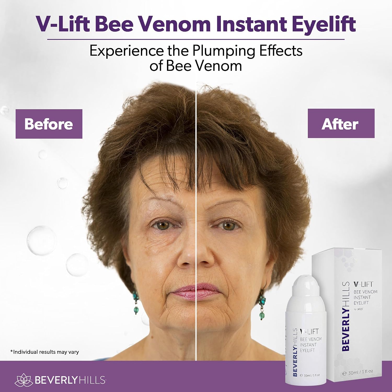 Beverly Hills V-Lift Instant Eye Lift and Eye Tuck Bee Venom Serum for Puffy Eyes, Dark Circles, Wrinkles