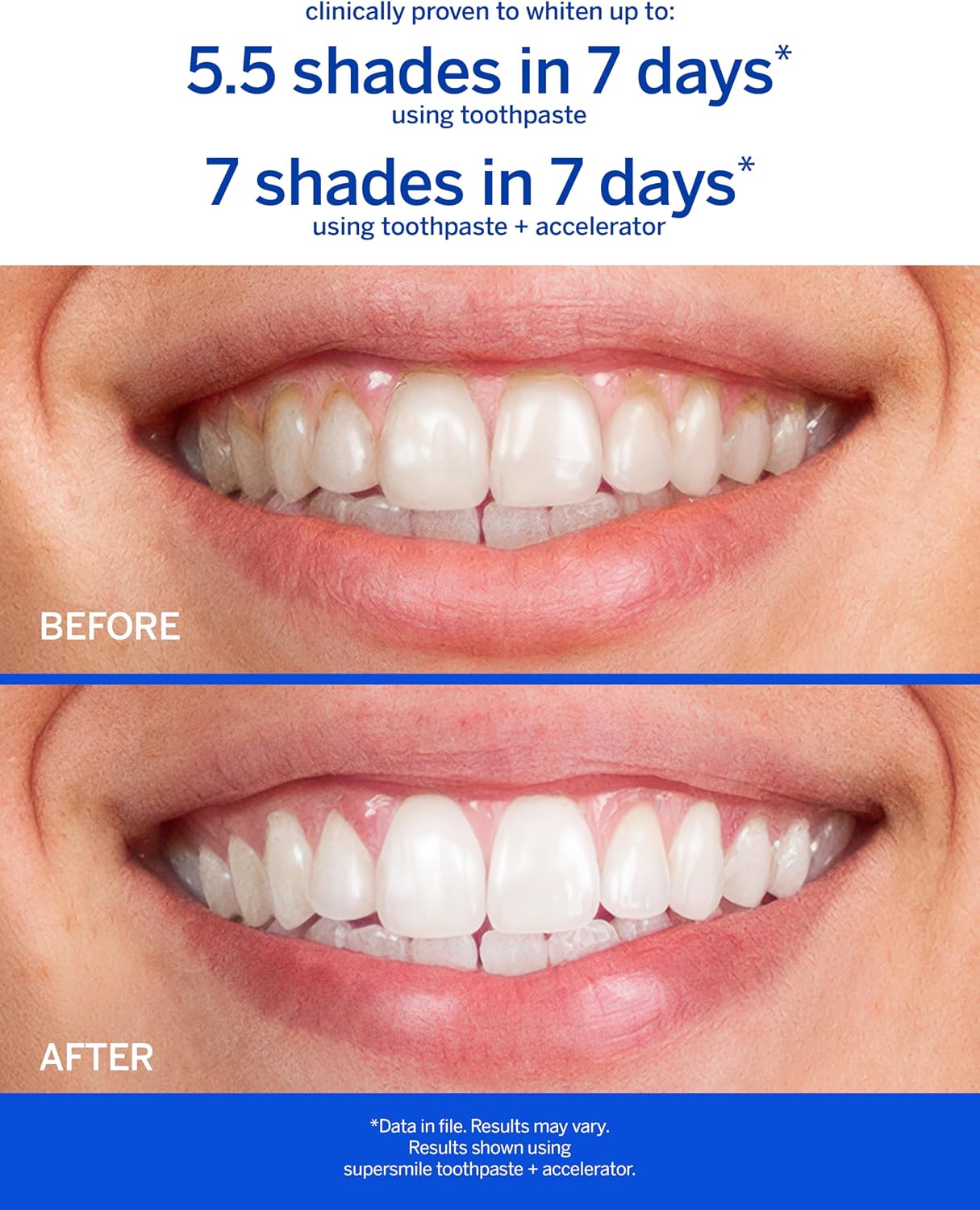 Supersmile Awake Zesty Mint Whitening Toothpaste, with Caffeine, 4.2 Oz