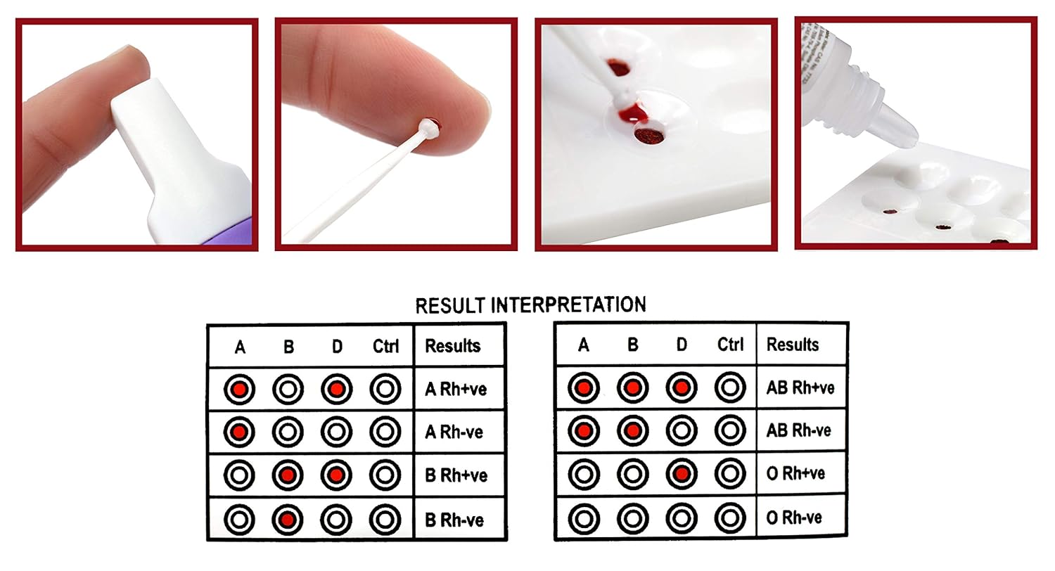ALDON Innovating Science ABO/RH Blood Type Test Kit - Educational Use, Erycard Blood Grouping Card, Buffer Solution, Alcohol Wipe, Lancet