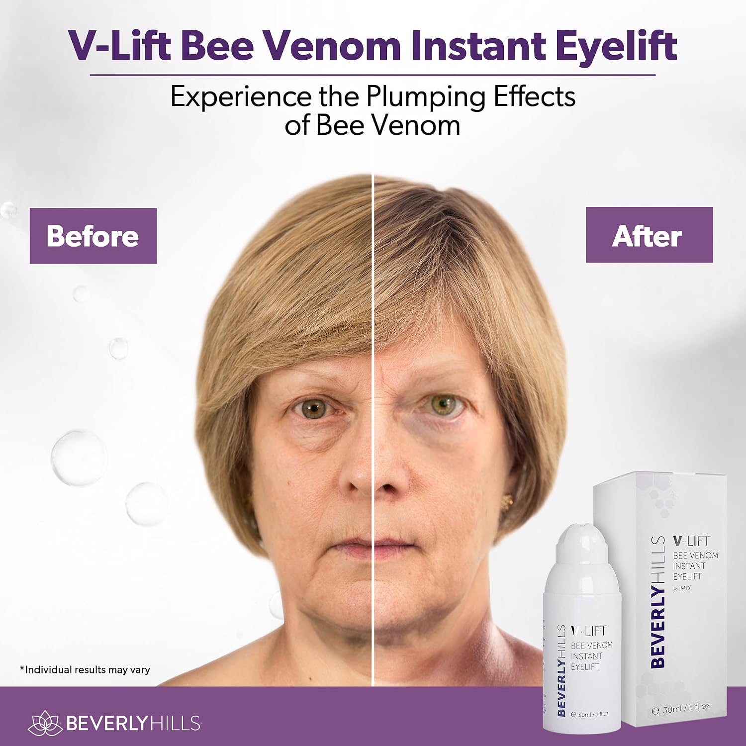 Beverly Hills V-Lift Instant Eye Lift and Eye Tuck Bee Venom Serum for Puffy Eyes, Dark Circles, Wrinkles