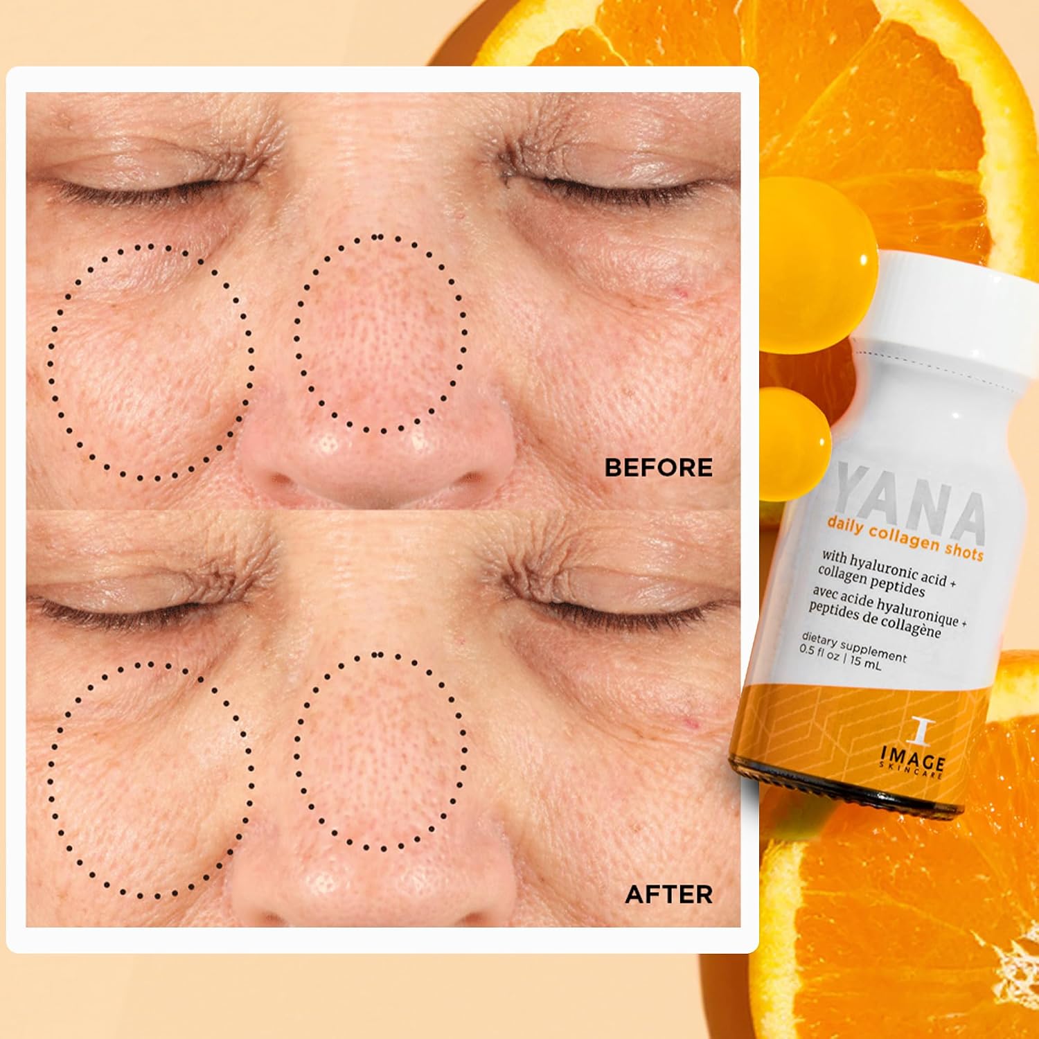 IMAGE Skincare, YANA Liquid Collagen Shots, 28 Daily Shots | 2500 mg Hydrolyzed Bovine Collagen Peptide Supplement with Biotin, Natural Citrus Flavor