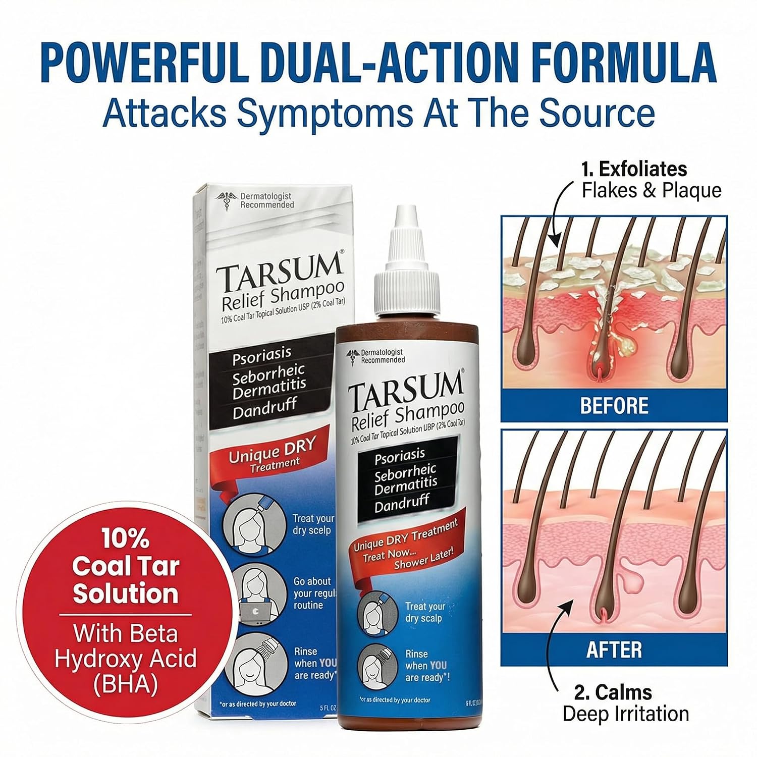 Tarsum Extra Strength Psoriasis Shampoo - Coal Tar Shampoo and Conditioner for Scalp Psoriasis, Seborrheic Dermatitis, Severe Dandruff, & Eczema - Exfoliating Relief for Flaky, & Itchy Scalp (4 oz)