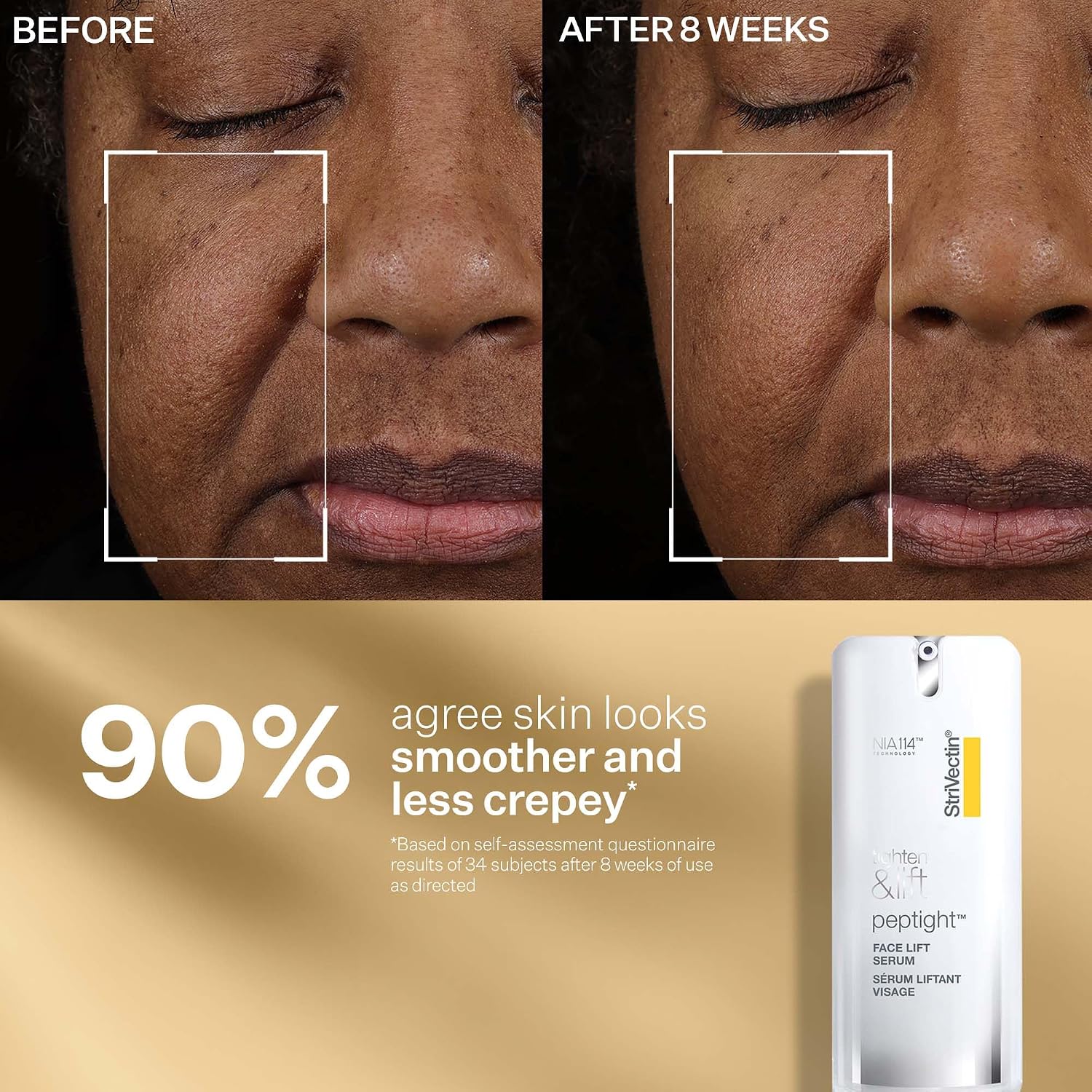 StriVectin Tighten & Lift Peptight Face Lift Serum with Tightening & Brightening Peptides for Wrinkles