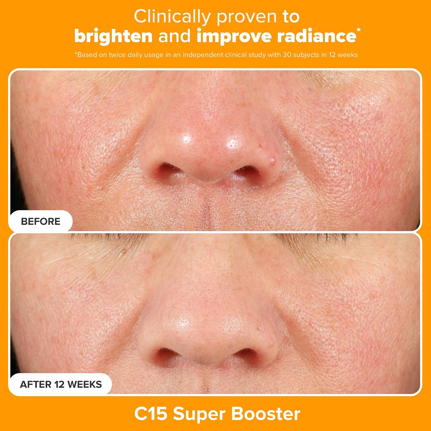 Paula's Choice BOOST C15 Super Booster 15% Vitamin C Face Serum | Daily Serum with Vitamin E & Ferulic Acid for Discoloration & Glow, Fragrance-Free