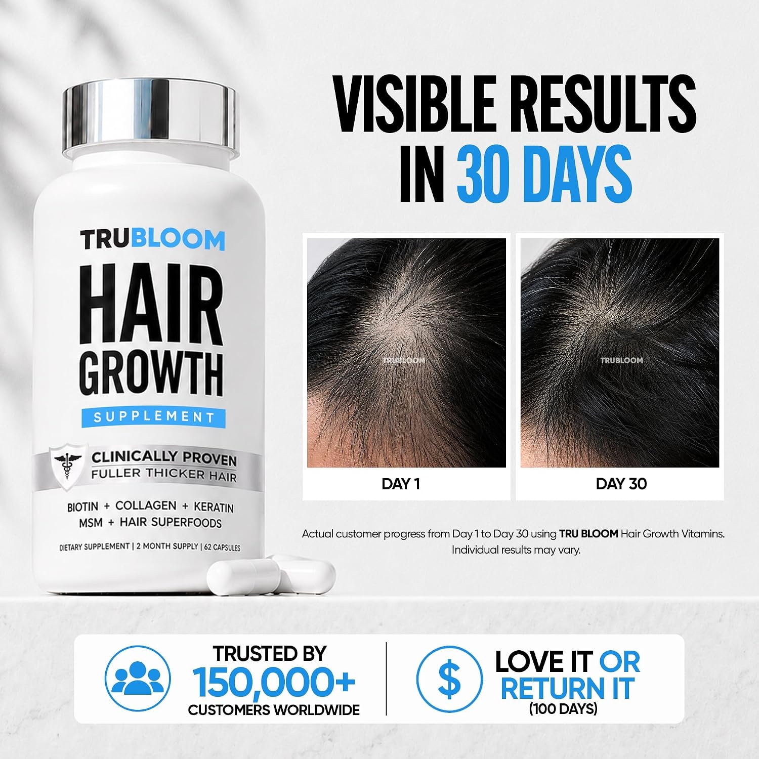 TRU BLOOM Hair Vitamins for Women and Men | Clinically Proven Hair Growth Supplements for Thinning Hair, Hair Loss, Thicker Fuller Hair | Biotin Collagen Keratin, Hair Growth Vitamins with DHT Blocker