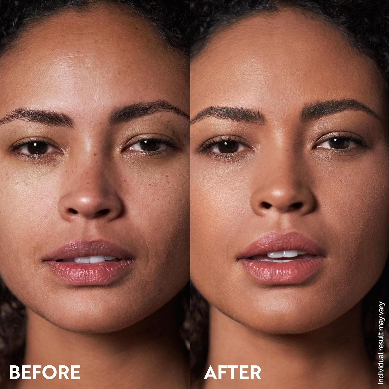 M. Asam Magic Finish Make-up Mousse (1.01 Fl Oz) | 4in1 Primer, Foundation, Concealer & Powder With Buildable Coverage, Hides Redness And Dark Spots, Light To Medium Skin