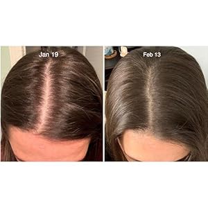 Hair loss growth regrowth dht blocker block thin thinning stimulate women men bald balding