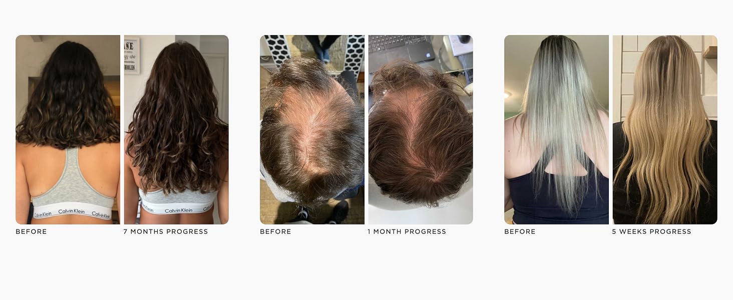 Progress