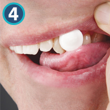 dry mouth tabs, dry mouth relief, dry mouth remedy, biotene, throat lozenges, best dry mouth