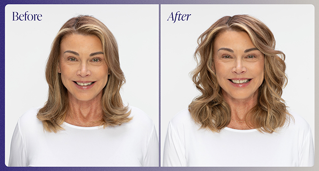 Volume Spray 25